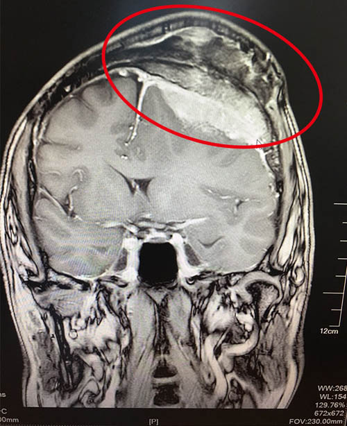 �XĤ�����g(sh��)��Ҫע�������{(di��o)�B(y��ng)��