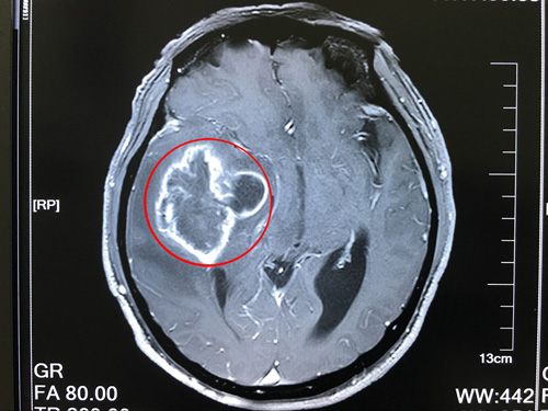 �X�z�|(zh��)����Ҫ����Щ�z����