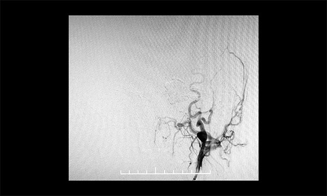 ΢��(d��o)����Ӱ�_�J(r��n)����ע�� Onyx 18�z7.5ml