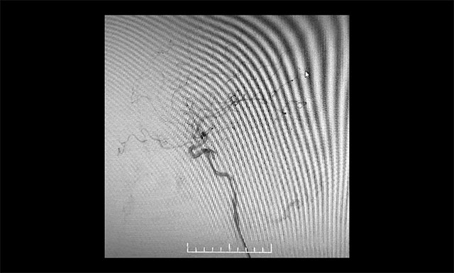 �g(sh��)�����(c��)�i��(n��i)���}��Ӱ