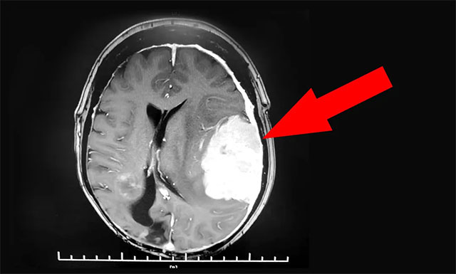 �������(c��)�D��~�޴�ռλ