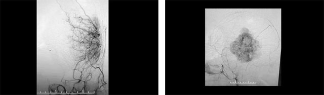 �[������Ѫ���S��