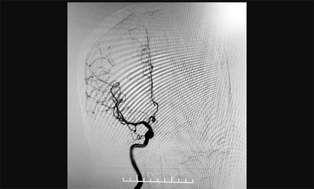 �c���y(t��ng)��(j��ng)�Ʉ�(d��ng)�}�����XѪ����Ӱ�������(j��ng)���(d��ng)�}������Ӱ����(du��)��(f��)�s�������g(sh��)��(chu��ng)��С�������c(di��n)Ѫ�[�l(f��)�����^��