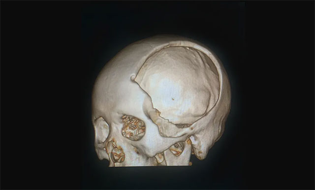 �����B�Ǵ���eȱ�p