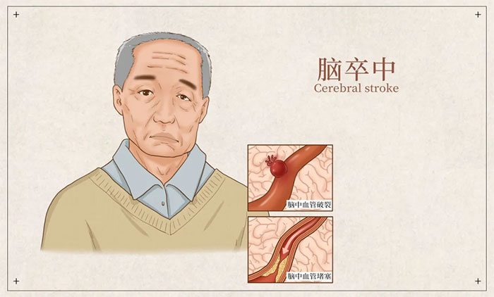 �������� �� ����������֔(j��n)���������L(f��ng)��ͻȻ��(l��i)�u��