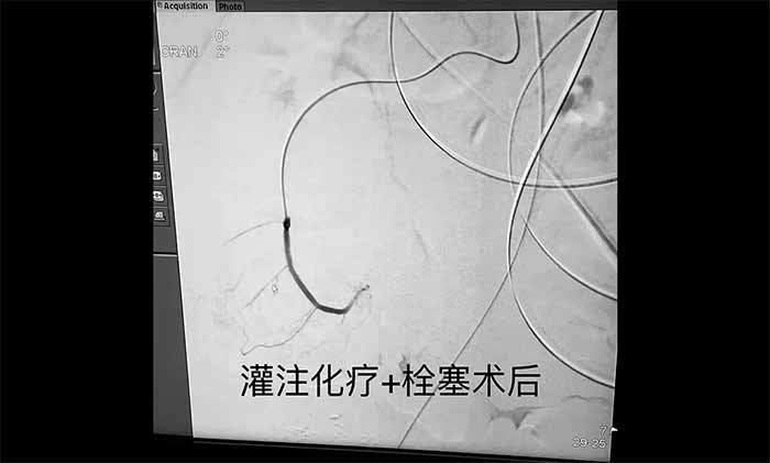 ���g(sh��)�x�� �t(y��)�����|(zh��) | ��Ժ��(j��ng)��(d��ng)�}��ע����(li��n)��Ѫ��˨�����뼼�g(sh��)�_(k��i)�ِ����[���ί���·��