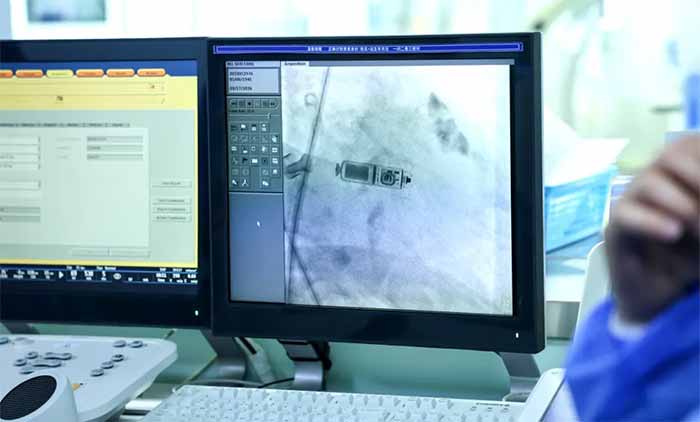 �o(w��)�������c(di��n)�����ġ�ϣ�� | ��Ժ�ɹ��_(k��i)չ�����pǻ�o(w��)��(d��o)�����K����ֲ�����g(sh��)